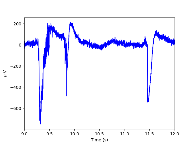 plot lfp data