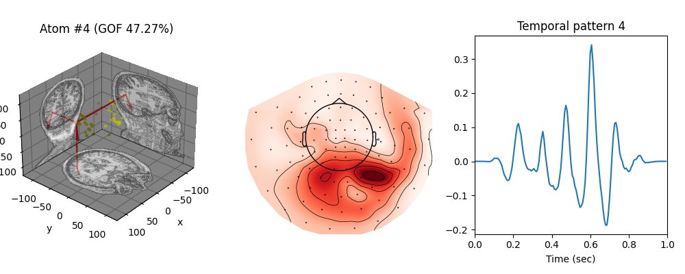 , Atom #4 (GOF 47.27%), Temporal pattern 4