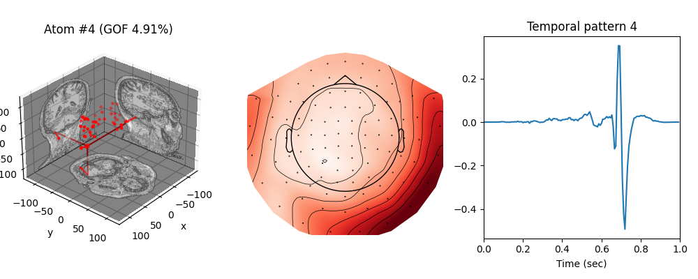 , Atom #4 (GOF 4.91%), Temporal pattern 4